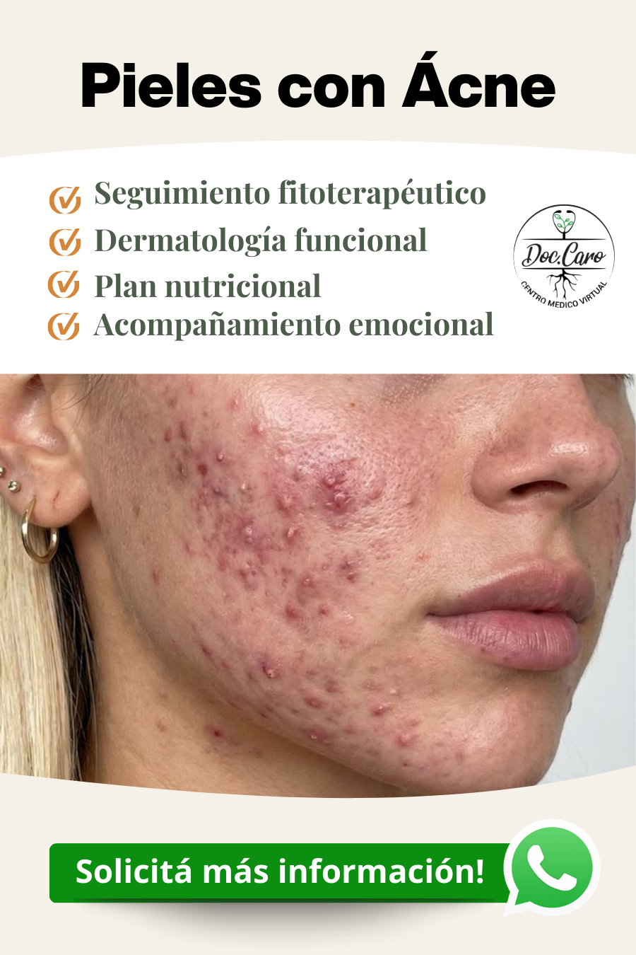 Plan Pieles con Acné - Doc.Caro Centro Médico Virtual